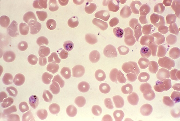 monkey, blood smear, falciparum, parasites, 24hrs, incubation, stain