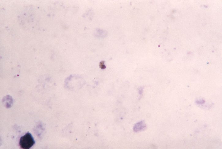 nota, Plasmodium falciparum, los gametocitos, visible, la cromatina, pigmento, evidente, el citoplasma
