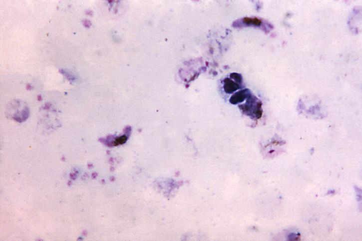 Observera att två, långsträckt, Plasmodiumfalciparum, gametocytes, tre, fyra, växande, plasmodium vivax, trophozoites