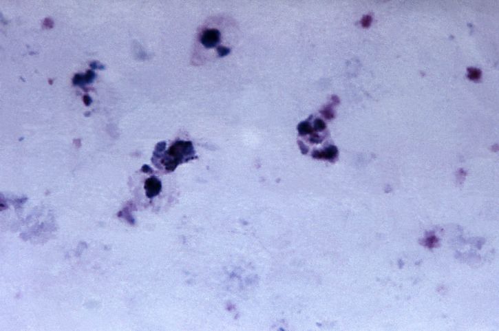 เก่า vivax, ameboid, trophozoite มองเห็น schuffners จุด ขยาย 1125 x