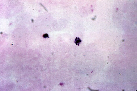 old, plasmodium malariae, trophozoites, immature, schizont, eight, chromatin, masses
