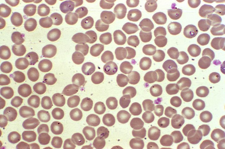 hemoprotozoan, 기생충, babesia, 닮은, 변형 체 falciparum, 말라리아, 생물