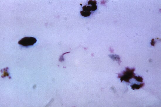Kostenlose Bild Mikroskopische Aufnahme Plasmodium Vivax Microgametocyte Blau Zytoplasma
