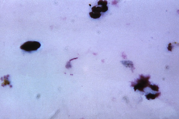 falciparum, vivax, ovale en malariae