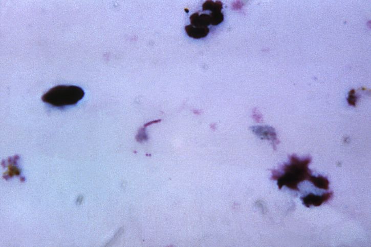 falciparum, vivax, ovale a malariae
