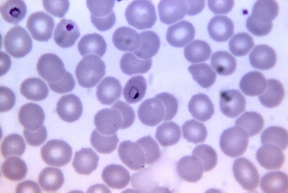 malariae, 环状, 大, 数量, 染色质, 坚固, 细胞质, 红细胞, 正常, 正常, 大小