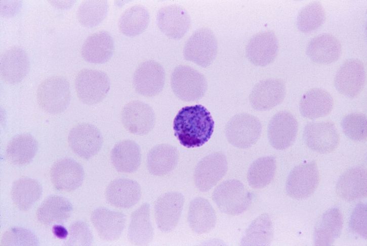 ovale, gametocytes, round, oval, brown, coarse, pigment, vivax