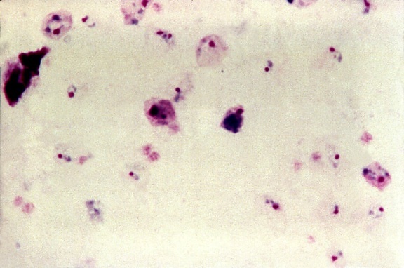 vivax, trophozoites, показують, двох, цитоплазми, великий хроматину точок, штрафу, жовтуватий, коричневий, пігмент