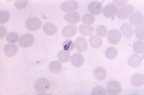 photomicrograph, growing, malariae, bond, form, trophozoite, smaller, normal, rbcs