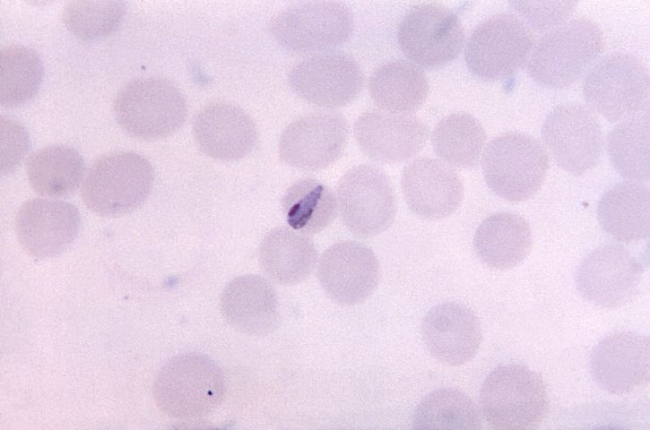 成長、四日熱マラリア、ボンド、フォーム、トロフォゾイト、小さい、通常、赤血球、顕微鏡写真