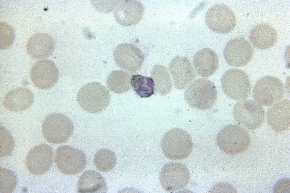 Fotomicrografia, madura, plasmodium malariae, trophozoite, assemelha-se, macrogametocyte