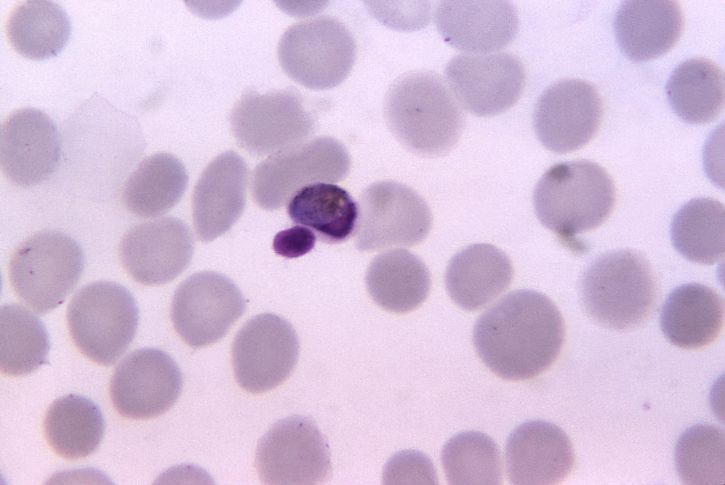 plasmodium malariae, trophozoite, gekleurd, volwassen, vlek, vergroot, 1125 x