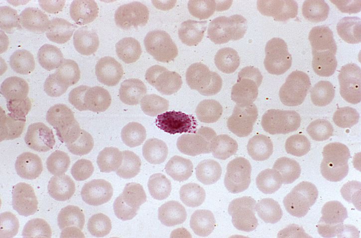 microphotographie, ovale, microgamétocyte, ovale, rouge, sang, cellules