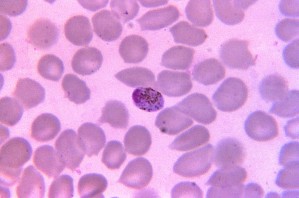 Kostenlose Bild Mikrophotographie Ovale Microgametocyte Oval Rot