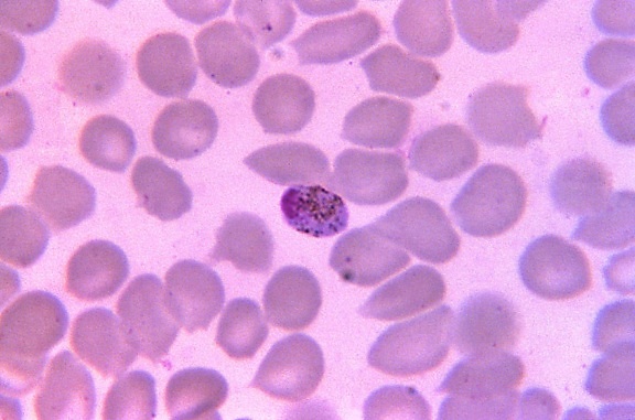microphotographie, plasmodium malariae, macrogamétocyte