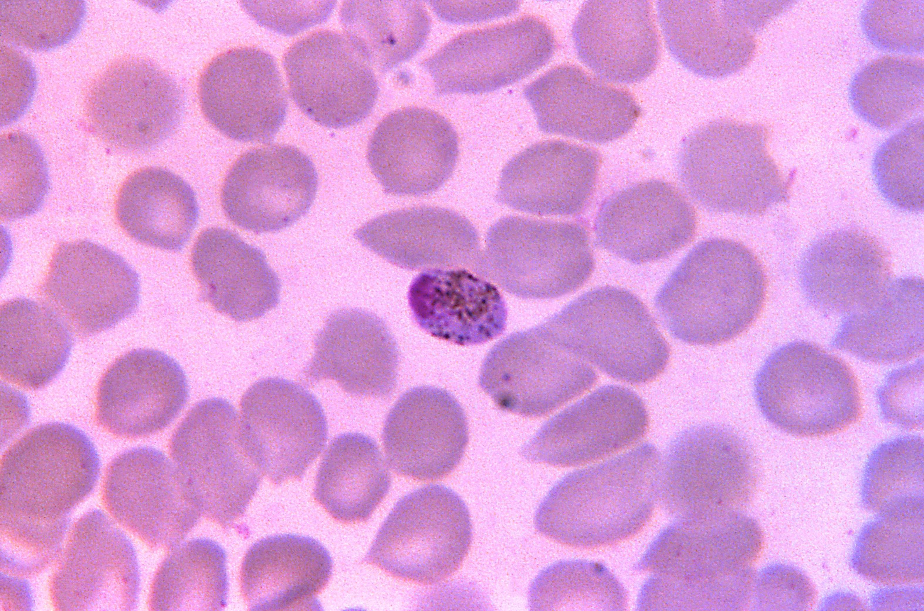 Free Picture Photomicrograph Plasmodium Malariae Macrogametocyte
