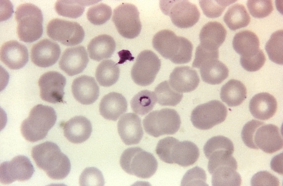 photomicrograph, plasmodium malariae, ring, stain, magnified, 1125x
