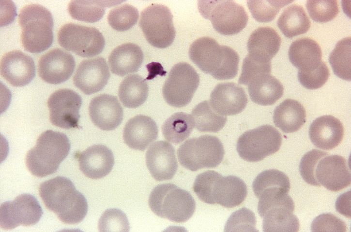 microphotographie, plasmodium malariae, anneau, tache, grossie, 1125x