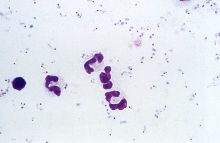 photomicrograph falciparum, parasites, form, numerous, rings, stain, mag, 1125x