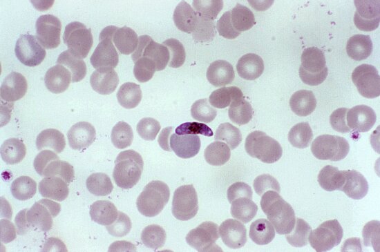 Free picture: photomicrograph, presence, immature, plasmodium vivax ...