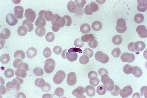 Fotomicrografia, esfregaço de sangue, macrogametocyte, parasita, plasmodium falciparum