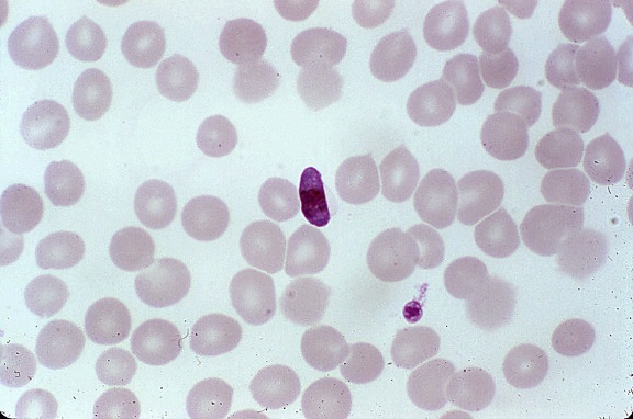 Fotomicrografia, esfregaço de sangue, microgametocyte, parasita, plasmodium falciparum