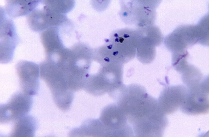 photomicrograph, darah smear, kehadiran, plasmodium vivax