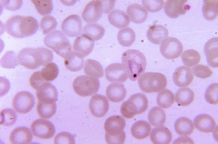 若い、成長、マラリア原虫の vivax アメーバ、虫垂の存在、血液塗抹標本顕微鏡写真