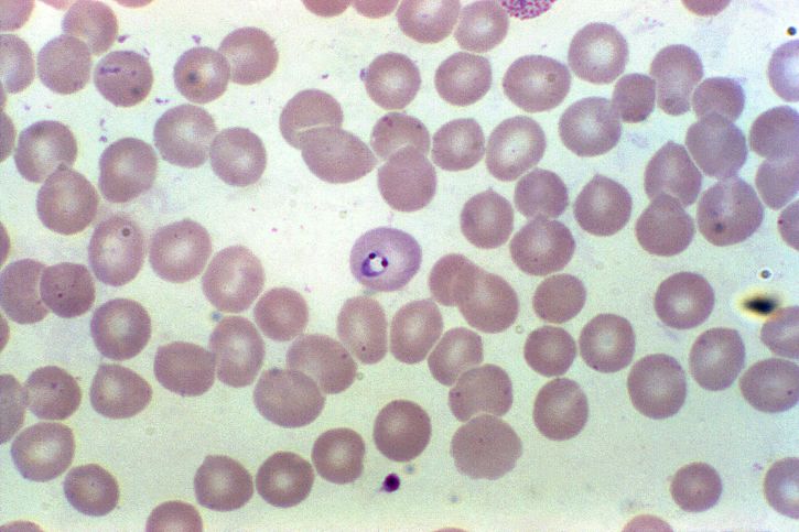 microfotografía, muestra de sangre, que revela, eritrocitos, Plasmodium vivax, parásito, magnificado, 1000x