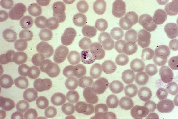 photomicrograph, blood smear, erythrocytes, developing, vivax, parasites, magnified, 1000x