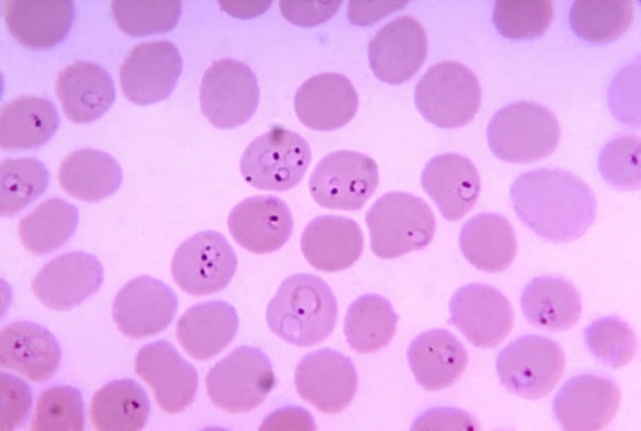 顕微鏡写真、血液塗抹標本、熱帯熱マラリア原虫、リング、赤血球