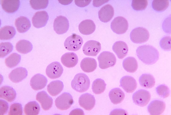 photomicrograph, frotiu de sânge, plasmodium falciparum, inele, eritrocite