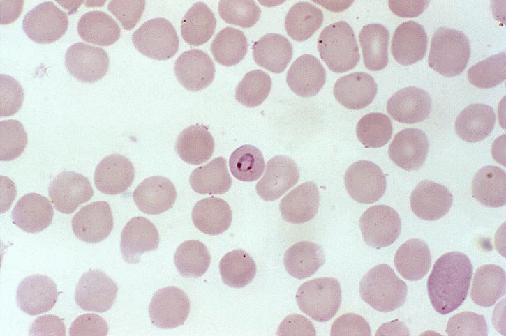 photomicrograph, frotiu de sânge, plasmodium malariae, paraziţi, infectare, hematii, inel, etapa