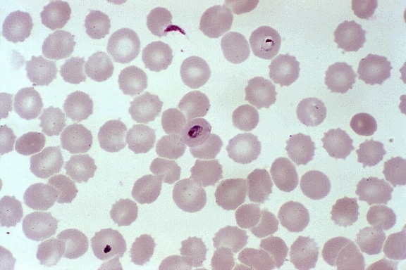 Fotomicrografia, esfregaço de sangue, anel, palco, plasmodium falciparum, infecção, sangue, células