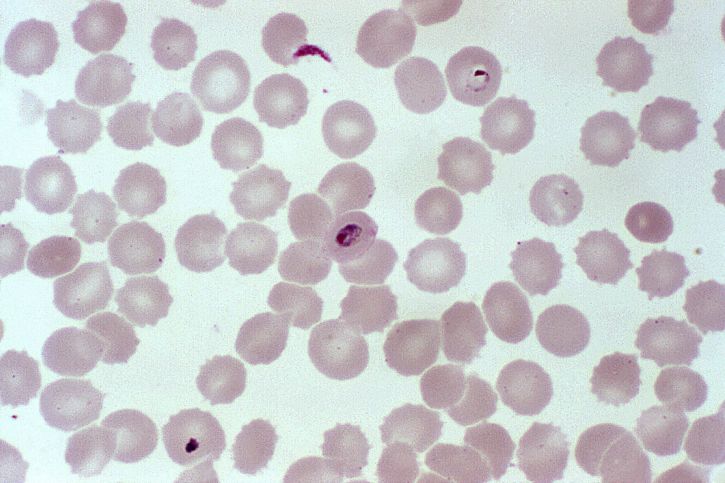 photomicrograph, blood smear, ring, stage, plasmodium falciparum, infection, blood, cells
