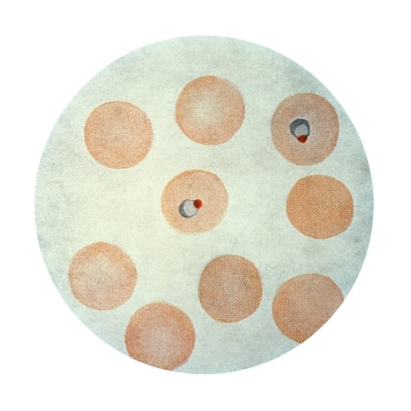 Микрофотография, malariae плазмодия, трофозоита, кольцо, этап, Райт, пятно, x1500
