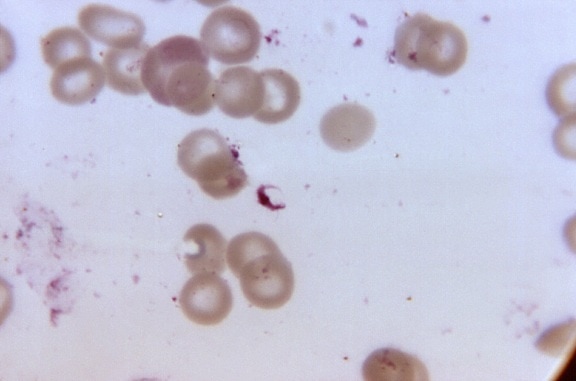 Mikrofotografie, ultra, Morphologie, ausgestellt, Plasmodium falciparum, gametocyte