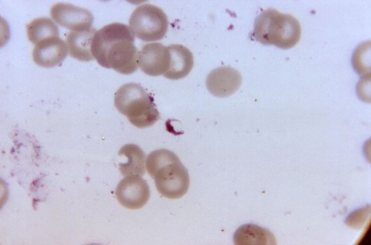 顕微鏡、微細構造、形態、展示、熱帯熱マラリア原虫の生殖母体