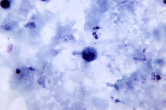 microphotographie, de présence, de plus en plus, plasmodium vivax, trophozoïte
