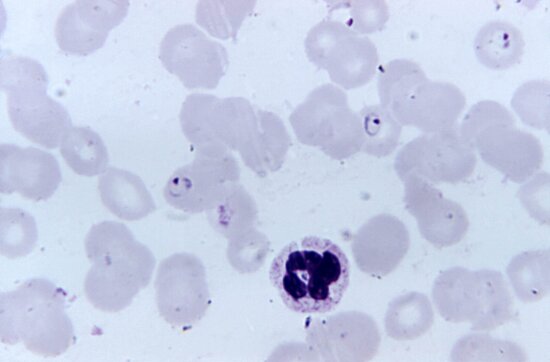 Kostenlose Bild Plasmodium Malariae Trophozoite Klein Fleck