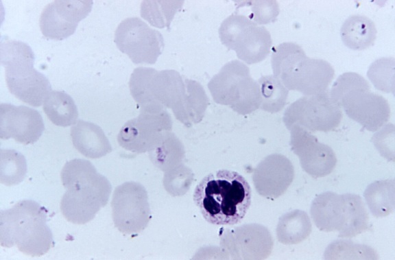 photomicrograph, shows, large, plasmodium falciparum, rings, stain, magnification, 1125x