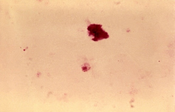 Plasmodium falciparum, los gametocitos, células, sangre, laboratorio