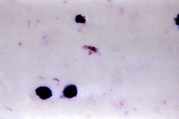 Plasmodium falciparum, gametocyte