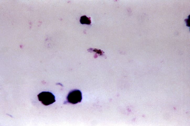 Плазмодий falciparum, gametocyte