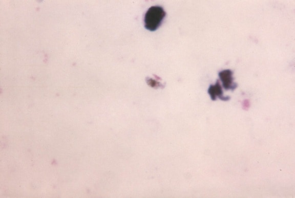 plasmodium falciparum, gametocytes, mature, crescent, sausage, shaped