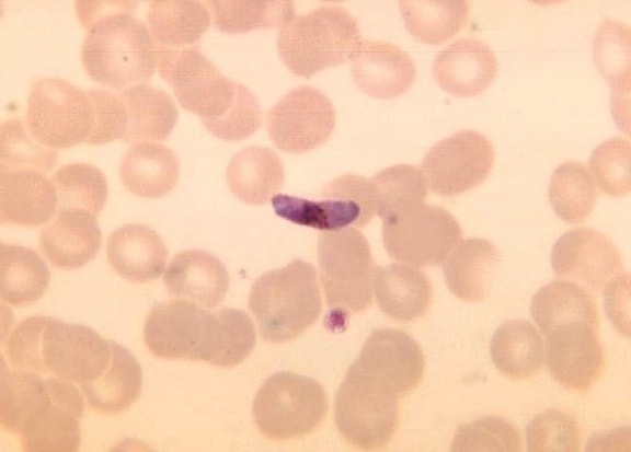 Plasmodium falciparum macrogametocyte, parassita