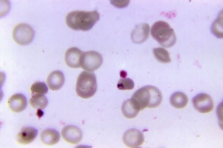 Plasmodium falciparum, malarii, pasożyt, krwi, próbki, pacjent