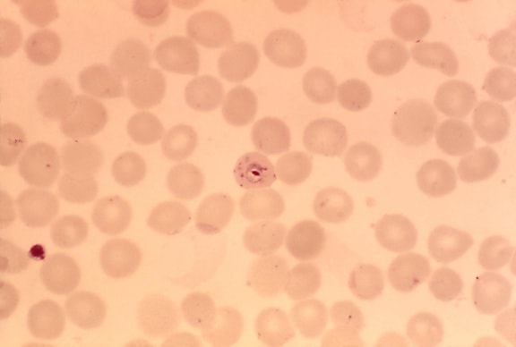 Plasmodium falciparum, ringen, delicaat, cytoplasma, chromatine, kleine puntjes