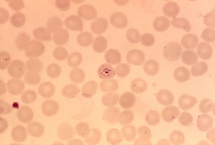 Плазмодий falciparum пръстени, деликатен, цитоплазмата, малки, Хроматинът, точки