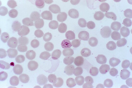 Kostenlose Bild Plasmodium Malariae Trophozoite Klein Fleck